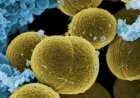 ما هي بكتيريا MRSA