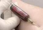 ما هو WBC في تحليل الدم