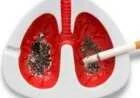 التدخين والسرطان