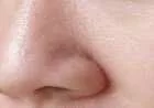 طريقة لغلق مسامات الوجه
