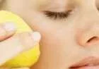 أضرار الليمون للبشرة