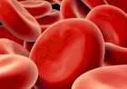 انخفاض خضاب الدم