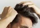 طريقة إزالة القشرة من الشعر للرجال