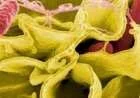 ما هي بكتيريا السالمونيلا