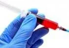 ما هو تحليل الدم