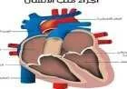 ما هو تحليل إنزيمات القلب
