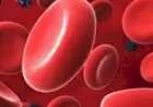 ما هي علامات فقر الدم