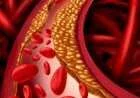 طرق تقليل نسبة الكولسترول في الدم