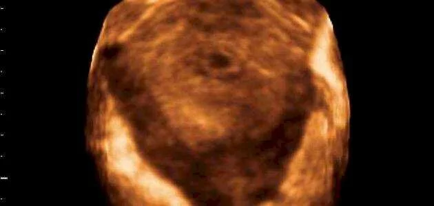 مقالة شكل الجنين في الشهر الثاني من الحمل